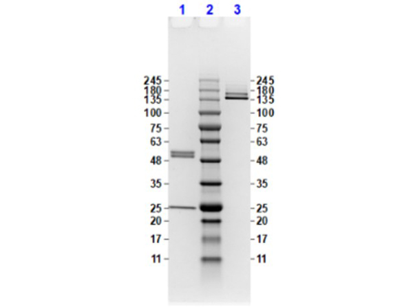 SDS-PAGE results using Anti-Feimin pT112